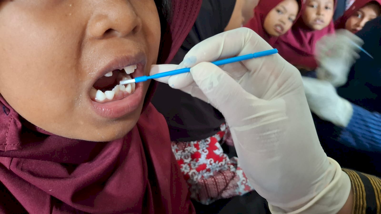 Senyum Sehat Sejak Dini : Program Imunisasi Gigi di SD Negeri 1 Solodiran